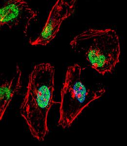 Anti-TBX6 Rabbit Polyclonal Antibody (FITC (Fluorescein Isothiocyanate))