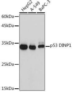 Western blot analysis of extracts of various cell lines, using Anti-TP53INP1 Antibody [ARC2102] (A308214) at 1:1000 dilution