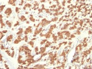 Anti-Cytokeratin 18 antibody