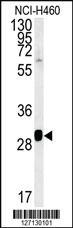 Anti-SC31B Rabbit Polyclonal Antibody