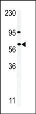 Anti-RIOK1 Rabbit Polyclonal Antibody