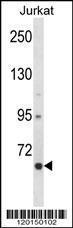 Anti-CRTC2 Rabbit Polyclonal Antibody (FITC (Fluorescein Isothiocyanate))