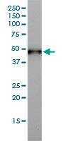 Anti-KRT17 Mouse Monoclonal Antibody [clone: 2D4-1G9]