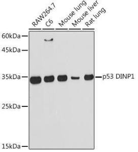 Western blot analysis of extracts of various cell lines, using Anti-TP53INP1 Antibody [ARC2102] (A308214) at 1:1000 dilution