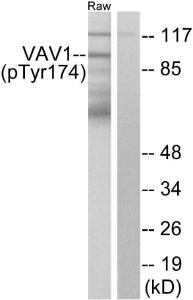 Anti-VAV1