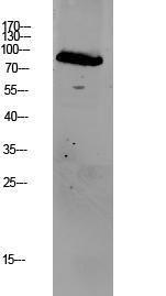 Western blot analysis of mouse liver lysate using Anti-GRK2 Antibody