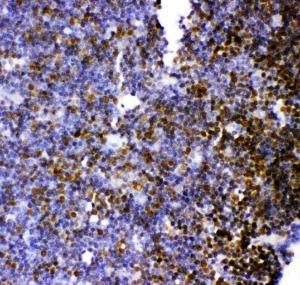 Anti-MCAK Polyclonal Antibody