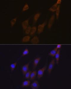 Anti-Peroxiredoxin 4 Rabbit Monoclonal Antibody [clone: ARC1442]