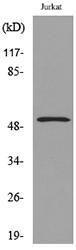 Western blot analysis of lysate from Jurkat cells using Anti-TUBA1A (acetyl Lys40) Antibody