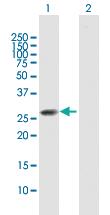 Anti-CLTB Mouse Polyclonal Antibody