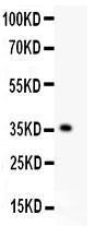 Anti-KLF6 Polyclonal Antibody