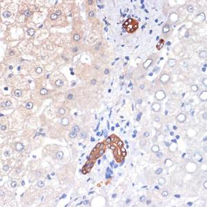 Immunohistochemistry analysis of paraffin-embedded human liver using Anti-TP53INP1 Antibody [ARC2102] (A308214) at a dilution of 1:100 (40x lens)