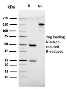 SDS-PAGE analysis of Anti-CD28 Antibody [C28/75] under non-reduced and reduced conditions; showing intact IgG and intact heavy and light chains, respectively. SDS-PAGE analysis confirms the integrity and purity of the antibody.