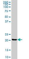 Anti-CLTB Mouse Polyclonal Antibody