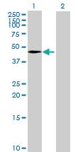 Anti-TIPIN Mouse Polyclonal Antibody