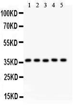 Anti-KLF6 Polyclonal Antibody