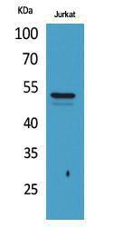 Western blot analysis of Jurkat cells using Anti-TUBA1A (acetyl Lys40) Antibody