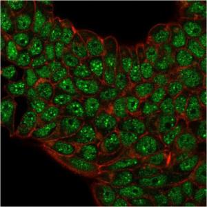 Immunofluorescent analysis of paraformaldehyde fixed MCF-7 cells stained with Anti-SUMO-2 + SUMO-3 Antibody [SM23/496] followed by Goat Anti-Mouse IgG (CFand#174; 488) (Green). Counterstain is Phalloidin (Red)