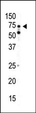 Anti-PRKAA2 Rabbit Polyclonal Antibody