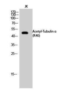 Western blot analysis of JK cells using Anti-TUBA1A (acetyl Lys40) Antibody