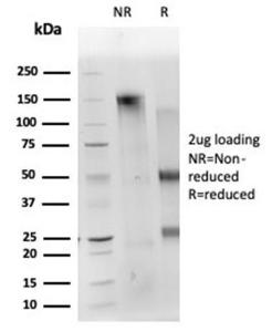 SDS-PAGE analysis of Anti-CD40L Antibody [CD40LG/4675] under non-reduced and reduced conditions; showing intact IgG and intact heavy and light chains, respectively. SDS-PAGE analysis confirms the integrity and purity of the antibody