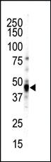 Anti-CAMK1D (CAMK1 delta) Rabbit Polyclonal Antibody