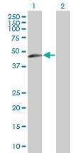 Anti-TIPIN Rabbit Polyclonal Antibody