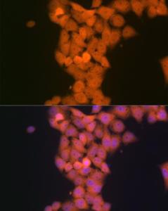 Immunofluorescence analysis of HeLa cells using Anti-TP53INP1 Antibody [ARC2102] (A308214) at a dilution of 1:100 (40x lens). DAPI was used to stain the cell nuclei (blue)