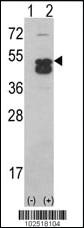 Anti-CAMK1D (CAMK1 delta) Rabbit Polyclonal Antibody