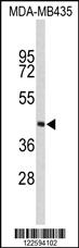 Anti-PHYH Rabbit Polyclonal Antibody