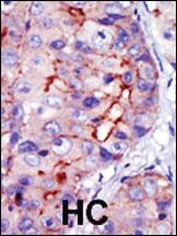 Anti-CAMK1D (CAMK1 delta) Rabbit Polyclonal Antibody