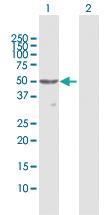 Anti-PNLIPRP1 Rabbit Polyclonal Antibody