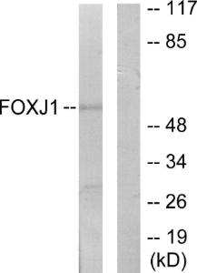 Western blot analysis of lysates from LOVO cells using Anti-FOXJ1 Antibody. The right hand lane represents a negative control, where the antibody is blocked by the immunising peptide.