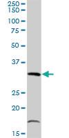 Anti-TIPIN Rabbit Polyclonal Antibody