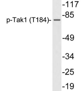 Western blot analysis of lysates from HepG2 cells treated with TNF using Anti-Tak1 (phospho Thr184) Antibody