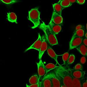 Anti-Cytokeratin 18 antibody