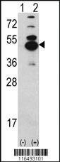 Anti-CAMK1D Rabbit Polyclonal Antibody