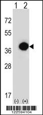 Anti-PHYH Rabbit Polyclonal Antibody