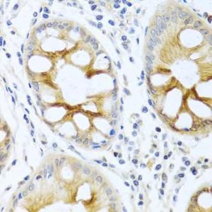 Immunohistochemistry analysis of paraffin-embedded human colon tissue using Anti-PKC alpha Antibody (A12587) at a dilution of 1:100 (40x lens). Perform microwave antigen retrieval with 10 mM PBS buffer pH 7.2 before commencing with IHC staining protocol.