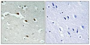 Immunohistochemical analysis of paraffin-embedded human brain using Anti-FOXJ1 Antibody 1:100 (4°C overnight). The right hand panel represents a negative control, where the antibody was pre-incubated with the immunising peptide.