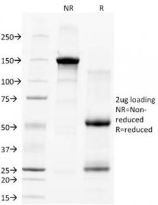 Anti-CD28 antibody