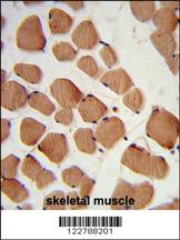 Anti-HACL1 Rabbit Polyclonal Antibody