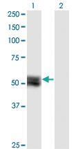 Anti-TNS4 Mouse Monoclonal Antibody [clone: 1C1]