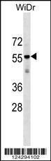 Anti-AGPAT9 Rabbit Polyclonal Antibody (APC (Allophycocyanin))