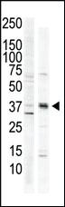 Anti-CAMK1 Rabbit Polyclonal Antibody