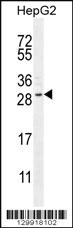 Anti-CCDC153 Rabbit Polyclonal Antibody