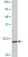 Anti-PBX4 Mouse Polyclonal Antibody