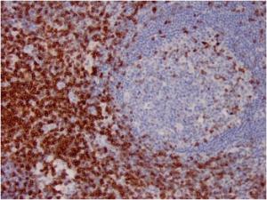 Immunohistochemical analysis of formalin-fixed, paraffin-embedded human lymph node using Anti-CD7 Antibody [CD7/3737]