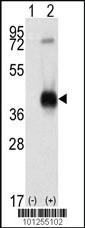 Anti-CAMK1 Rabbit Polyclonal Antibody