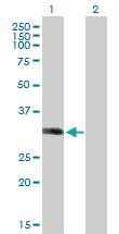 Anti-LYSMD2 Mouse Polyclonal Antibody